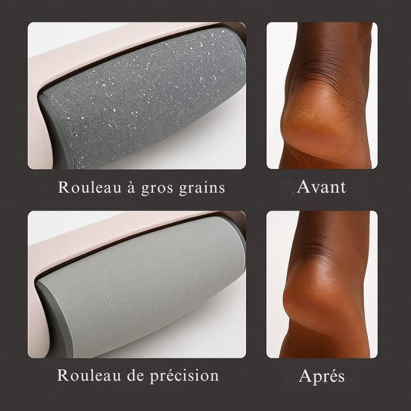 Râpe Électrique – Pieds Doux en 5 min