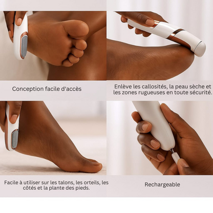 Râpe Électrique – Pieds Doux en 5 min